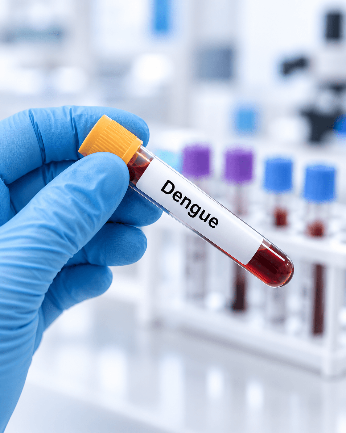 Blood sample tube labelled for dengue testing